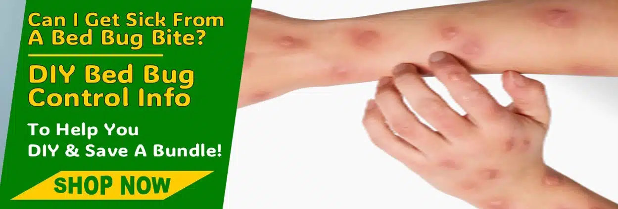 Can I Get Sick From A Bed Bug Bite